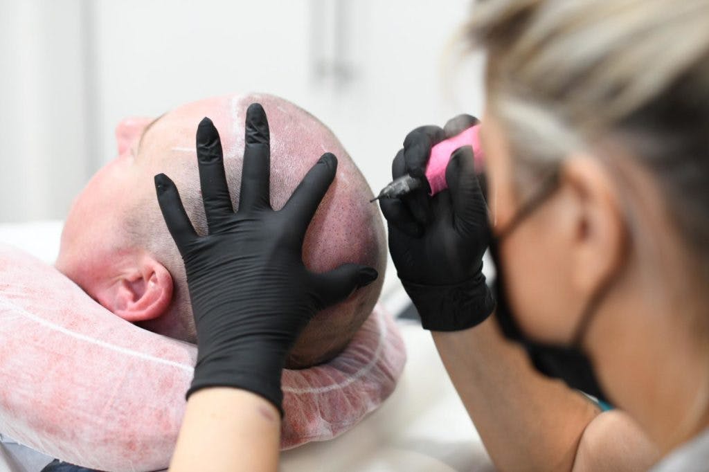 Scalp Micropigmentation Training At The Cosmetic College