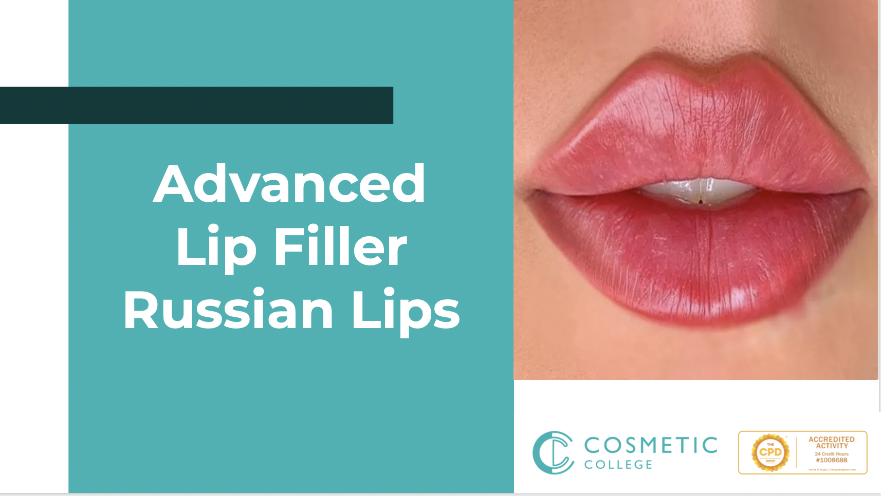 Online Advanced Lip Filler (Russian Lips)