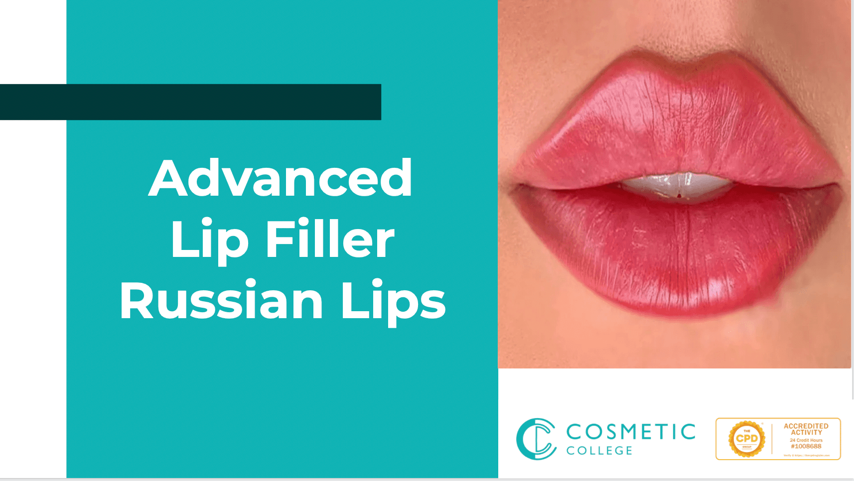 Online Advanced Lip Filler (Russian Lips)