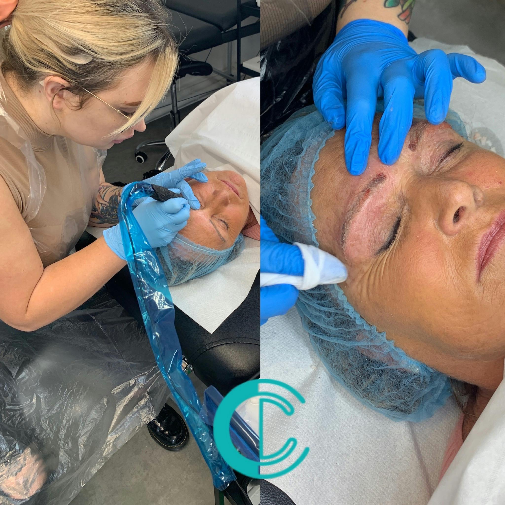 Permanent Makeup Removal Training At The Cosmetic College