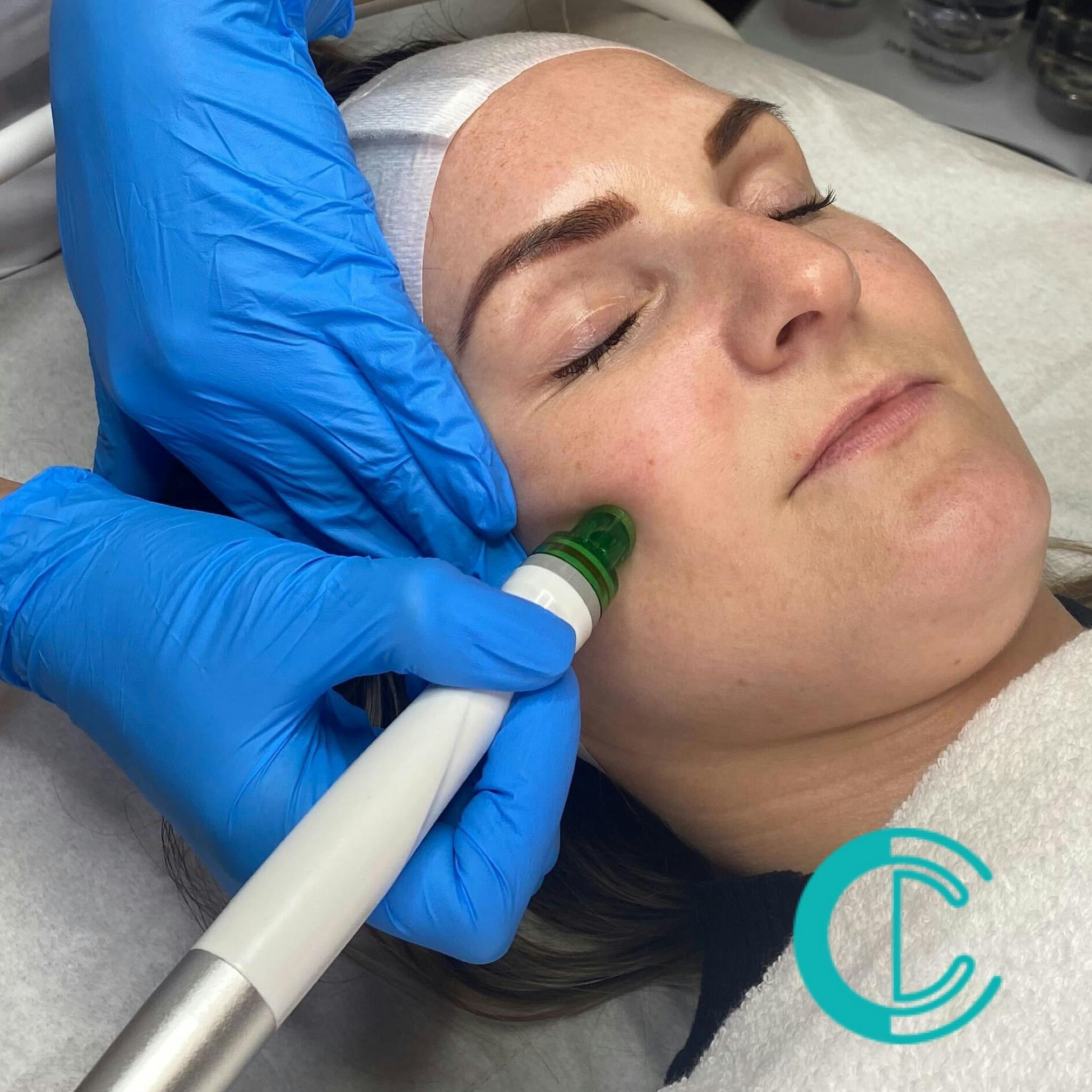 Hydra Dermabrasion Facial Training At The Cosmetic College