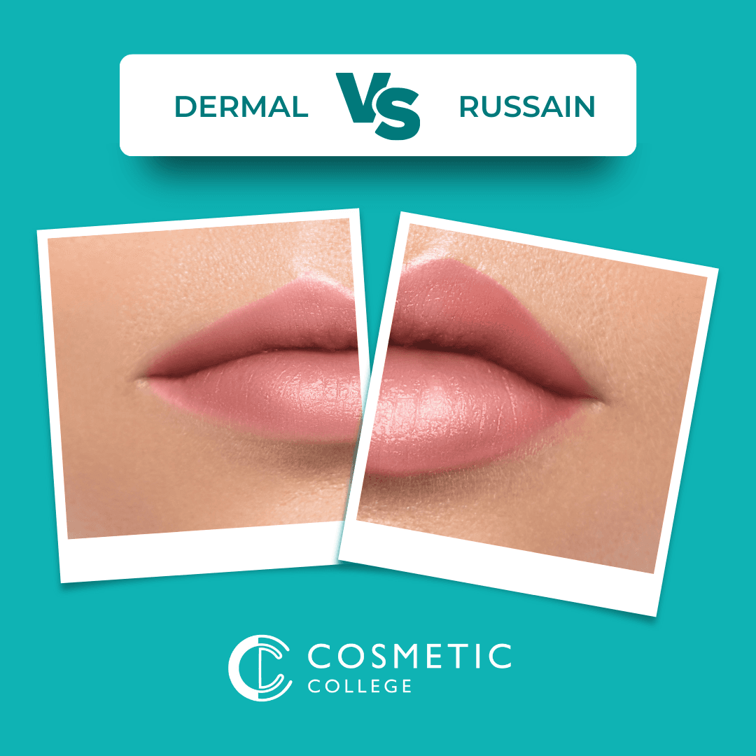 Dermal Filler Lips vs. Russian Lips: Which Technique Should You Train in and What's Best for Clients?