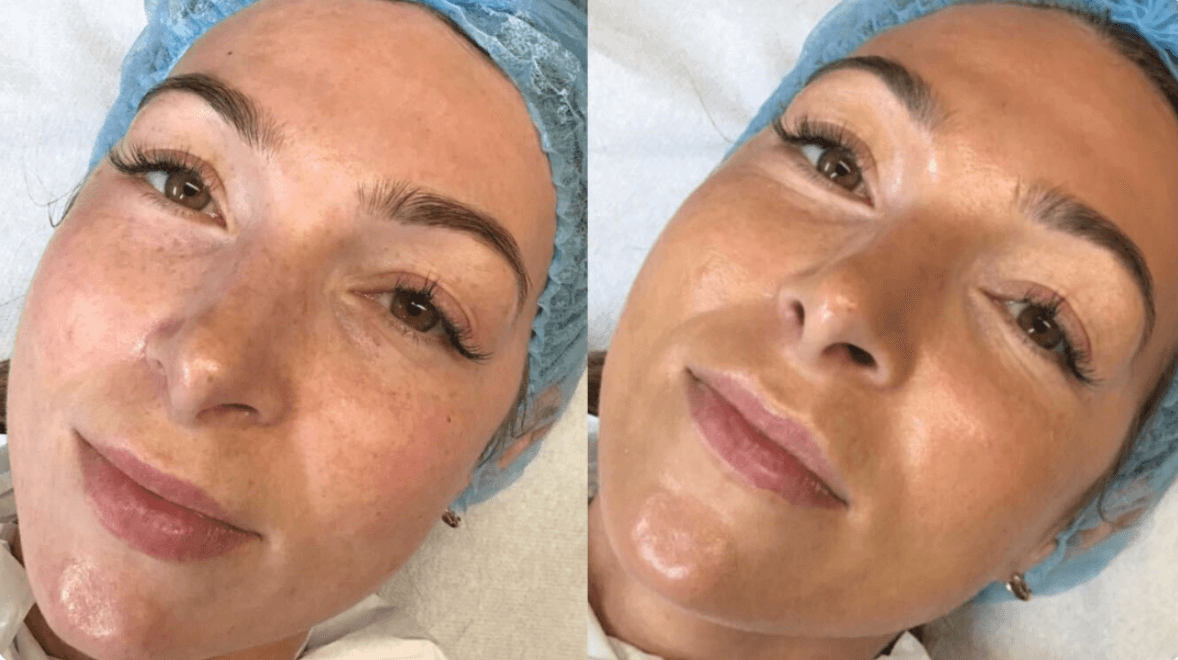 BB Glow Foundation Training