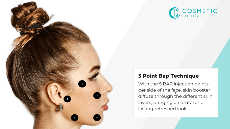 Revitalise skin with the BAP Technique: Profhilo & Seventy Hyal explained