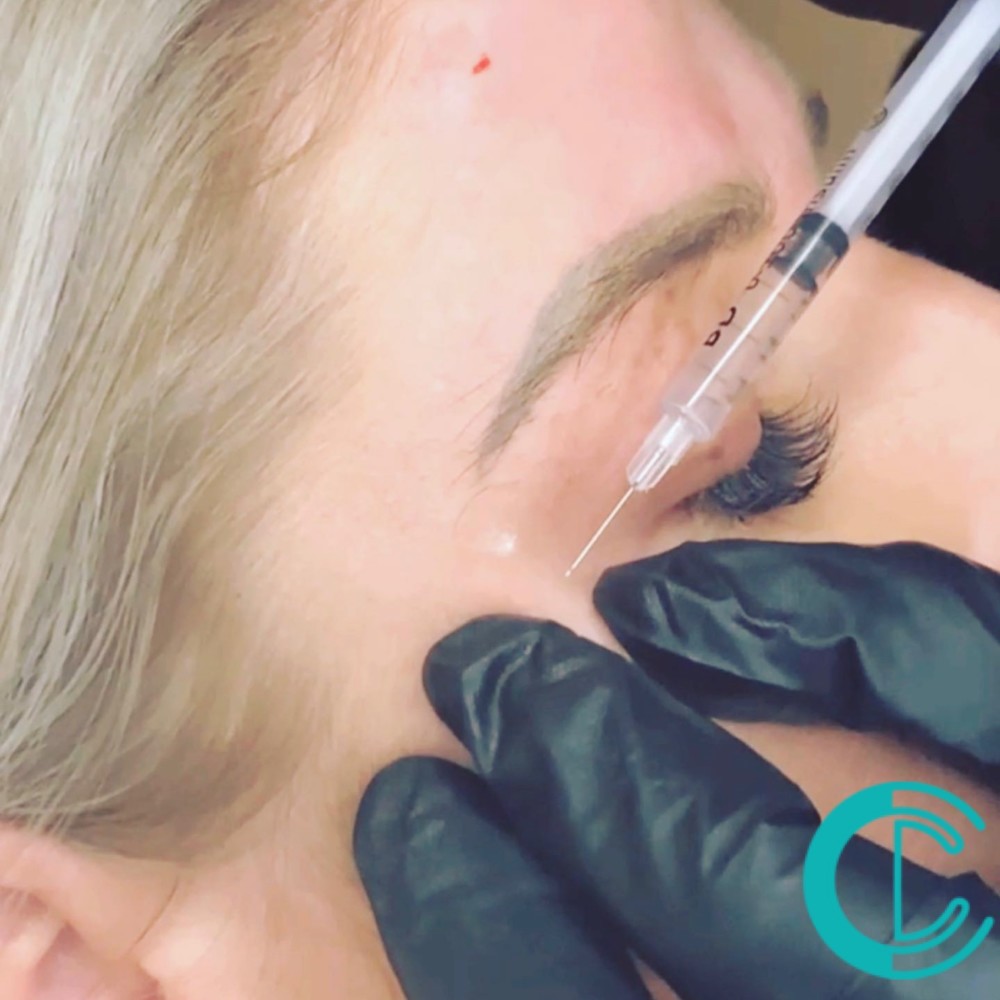 Anti Wrinkle Injection Training Package